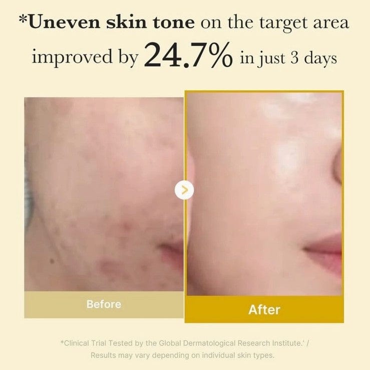 Medicube Kojic Acid Tumeric Wrapping Mask (2.53 fl oz)