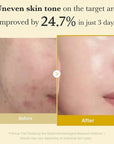 Medicube Kojic Acid Tumeric Wrapping Mask (2.53 fl oz)
