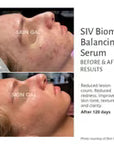 SIV Biome Balancing Serum-15 mL.