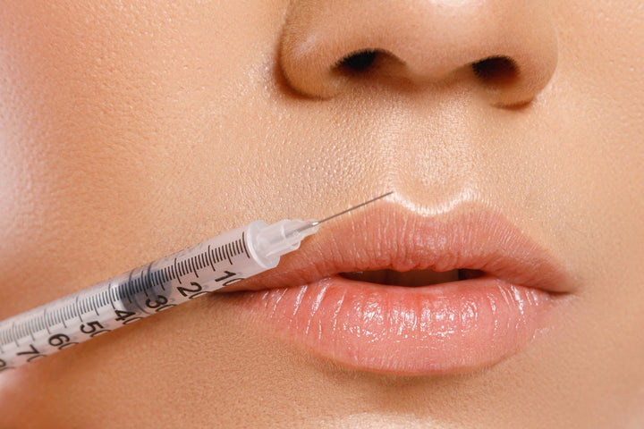 Lip Fillers & Lip Filler Trends - by Leigh Reese for Dermascope Magazine