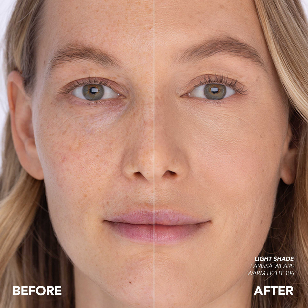 Dull Skin