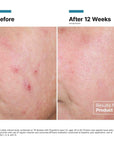 Skinceuticals Advanced RGN-6