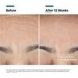Skinceuticals Advanced RGN-6