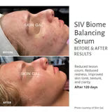 SIV Biome Balancing Serum-15 mL.