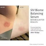 SIV Biome Balancing Serum-15 mL.