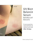SIV Biome Balancing Serum-15 mL.
