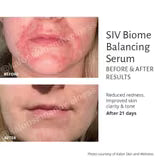 SIV Biome Balancing Serum-15 mL.