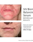 SIV Biome Balancing Serum-15 mL.