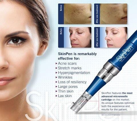 SkinRX Online Store Microneedling Package of 3