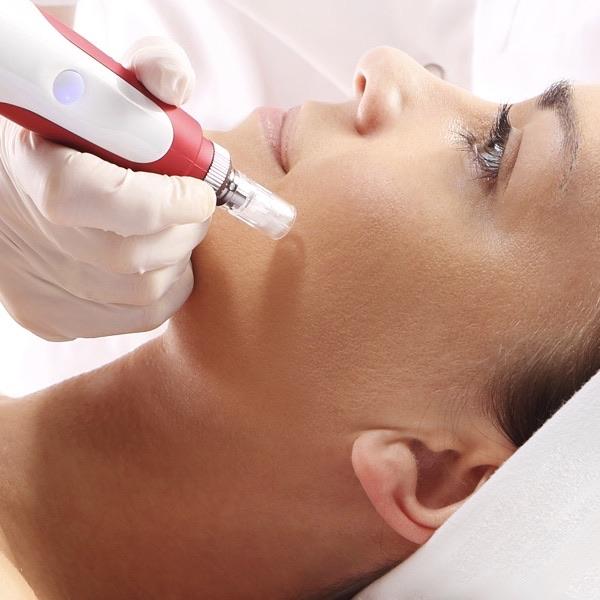 Microneedling - Collagen Induction Therapy